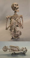 Corpse Erector